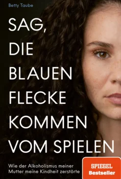 GRAU Sag, die blauen Flecke kommen vom Spielen Clearance