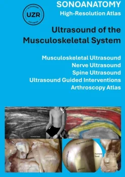 Sonoanatomy - High-Resolution Atlas - Ultrasound of the Musculoskeletal System-BoD - Books on Demand Discount